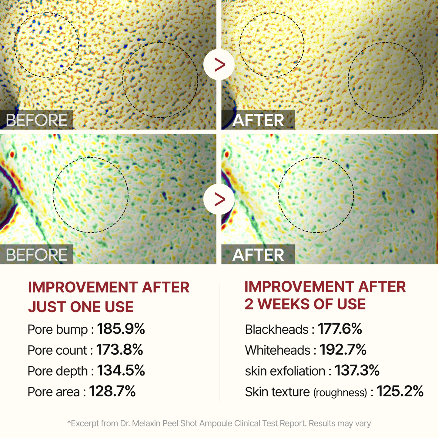 Dr. Melaxin 7-Piece Ultimate Skincare Bundle – Complete K-Beauty Routine with Melting Cleanser, Peel Shot Exfoliators, Calcium Spicule Serum & Eye Care – Anti-Aging, Pore Refining & Brightening for Face & Neck
