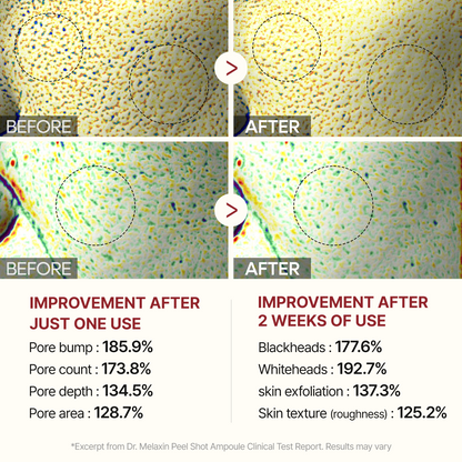 Dr. Melaxin 7-Piece Ultimate Skincare Bundle – Complete K-Beauty Routine with Melting Cleanser, Peel Shot Exfoliators, Calcium Spicule Serum & Eye Care – Anti-Aging, Pore Refining & Brightening for Face & Neck